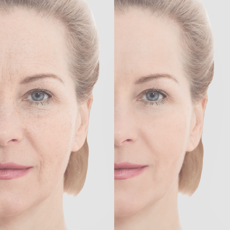 肌のビフォーアフターの様子